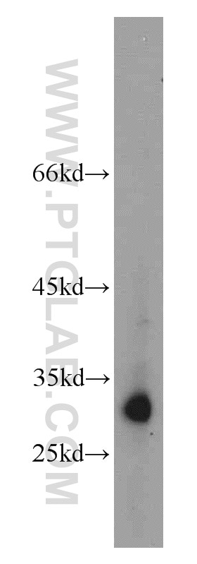 Western Blot (WB) analysis of HL-60 cells using KIR2DS4 Polyclonal antibody (21152-1-AP)