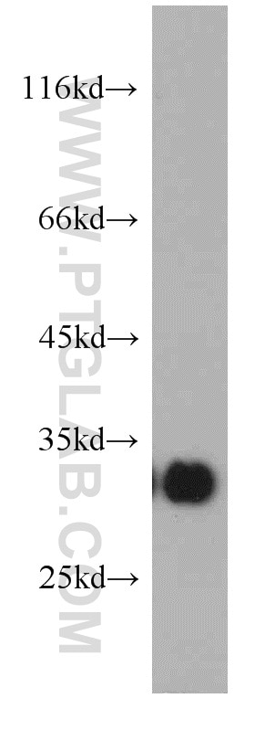 WB analysis of HL-60 using 21152-1-AP