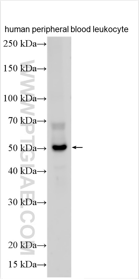 Western Blot (WB) analysis of various lysates using KIR3DL1/CD158E Polyclonal antibody (13335-1-AP)