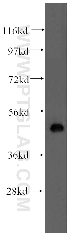 KIR3DL1