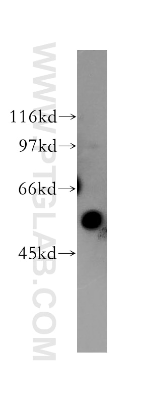 Western Blot (WB) analysis of human liver tissue using KIR3DL1 Polyclonal antibody (13335-1-AP)