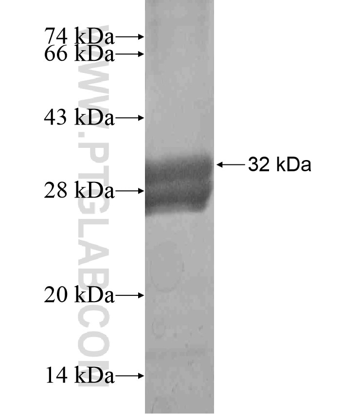 KIR3DL3 fusion protein Ag18217 SDS-PAGE