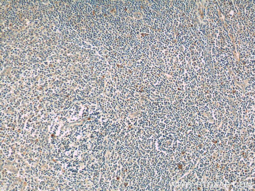 Immunohistochemistry (IHC) staining of human tonsillitis tissue using KIR3DX1 Polyclonal antibody (17583-1-AP)