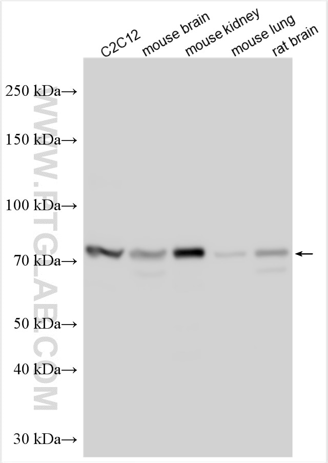 Western Blot (WB) analysis of various lysates using KIRREL Polyclonal antibody (22232-1-AP)