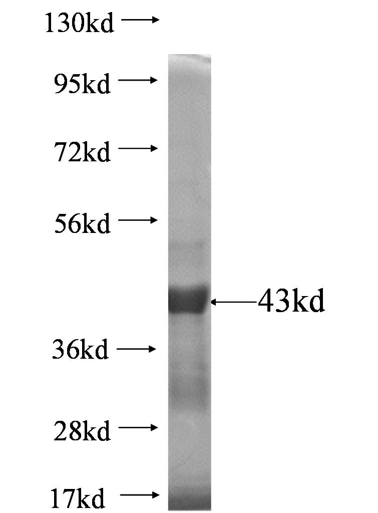 KIRREL fusion protein Ag0638 SDS-PAGE