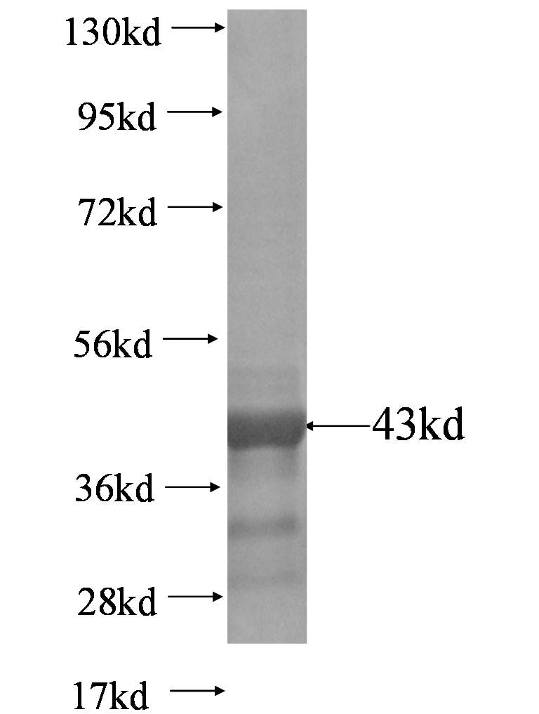 KIRREL fusion protein Ag0639 SDS-PAGE