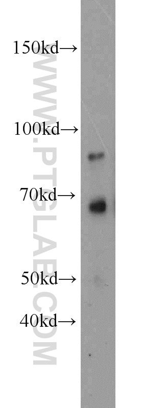 Western Blot (WB) analysis of mouse liver tissue using KIRREL2 Polyclonal antibody (10890-1-AP)