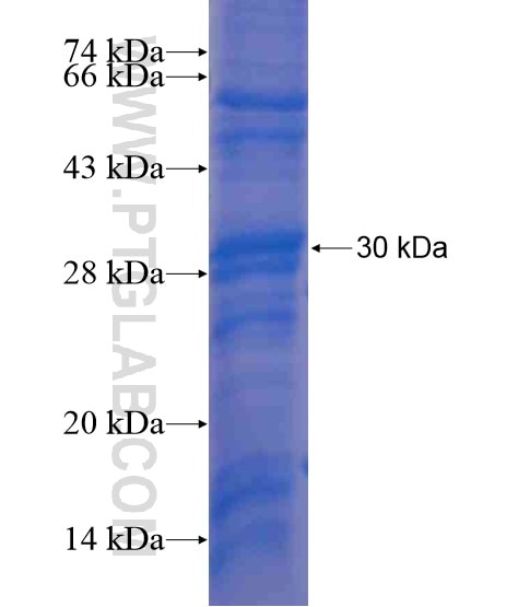 KIRREL2 fusion protein Ag21312 SDS-PAGE KIRREL2 fusion protein Ag21312 SDS-PAGE