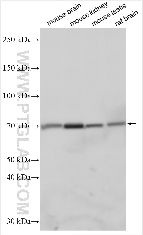 Western Blot (WB) analysis of various lysates using KIRREL3 Polyclonal antibody (18055-1-AP)