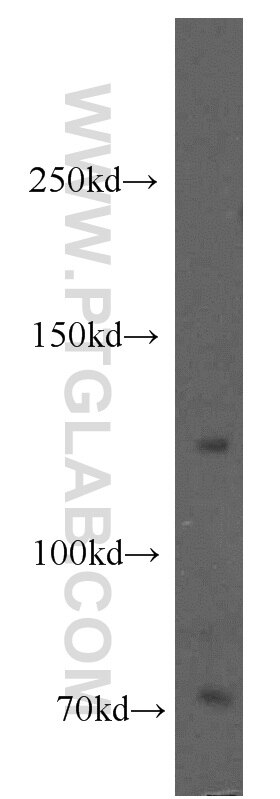 Western Blot (WB) analysis of mouse testis tissue using KIRREL3 Polyclonal antibody (18055-1-AP)