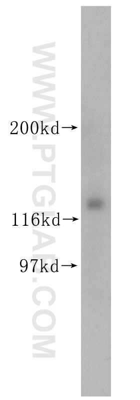 Western Blot (WB) analysis of mouse testis tissue using KIRREL3 Polyclonal antibody (18055-1-AP)