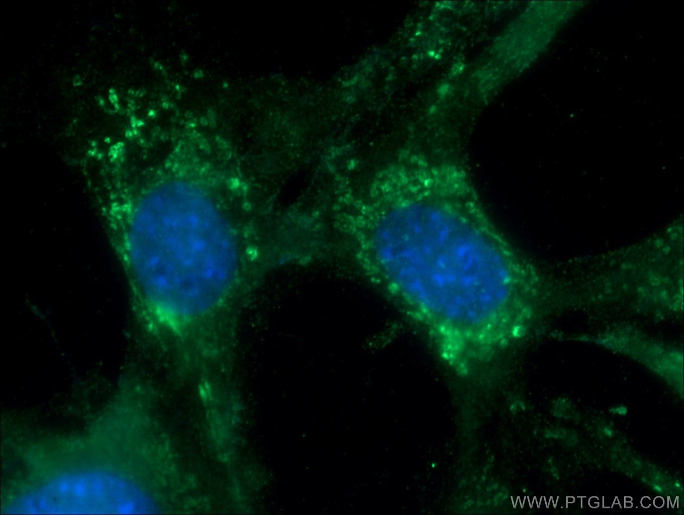 IF Staining of NIH/3T3 using 18375-1-AP