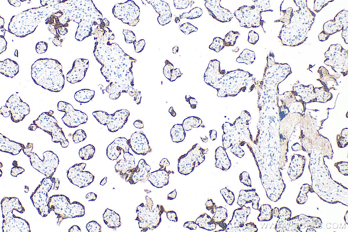 Immunohistochemistry (IHC) staining of human placenta tissue using KISS1 Polyclonal antibody (18375-1-AP)
