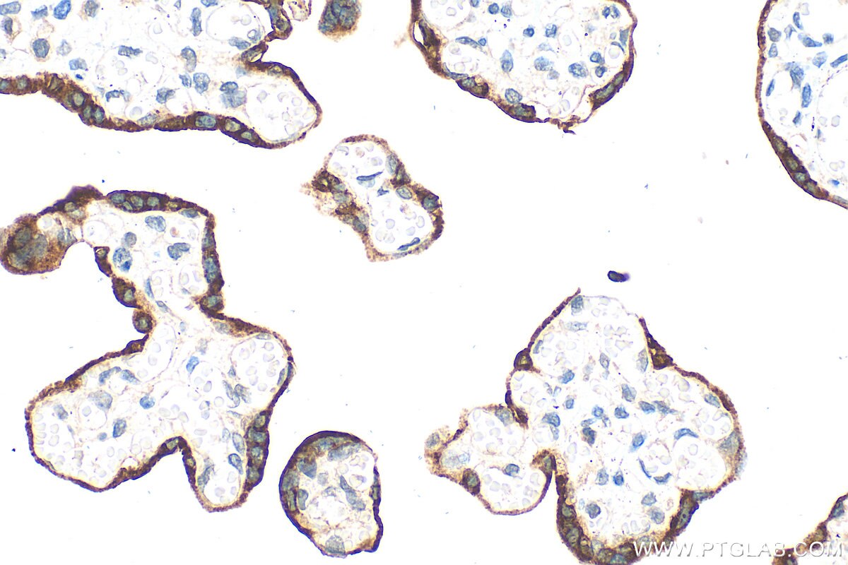 Immunohistochemistry (IHC) staining of human placenta tissue using KISS1 Polyclonal antibody (18375-1-AP)