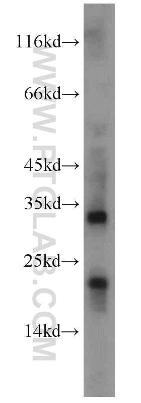 Western Blot (WB) analysis of mouse brain tissue using KISS1 Polyclonal antibody (18375-1-AP)