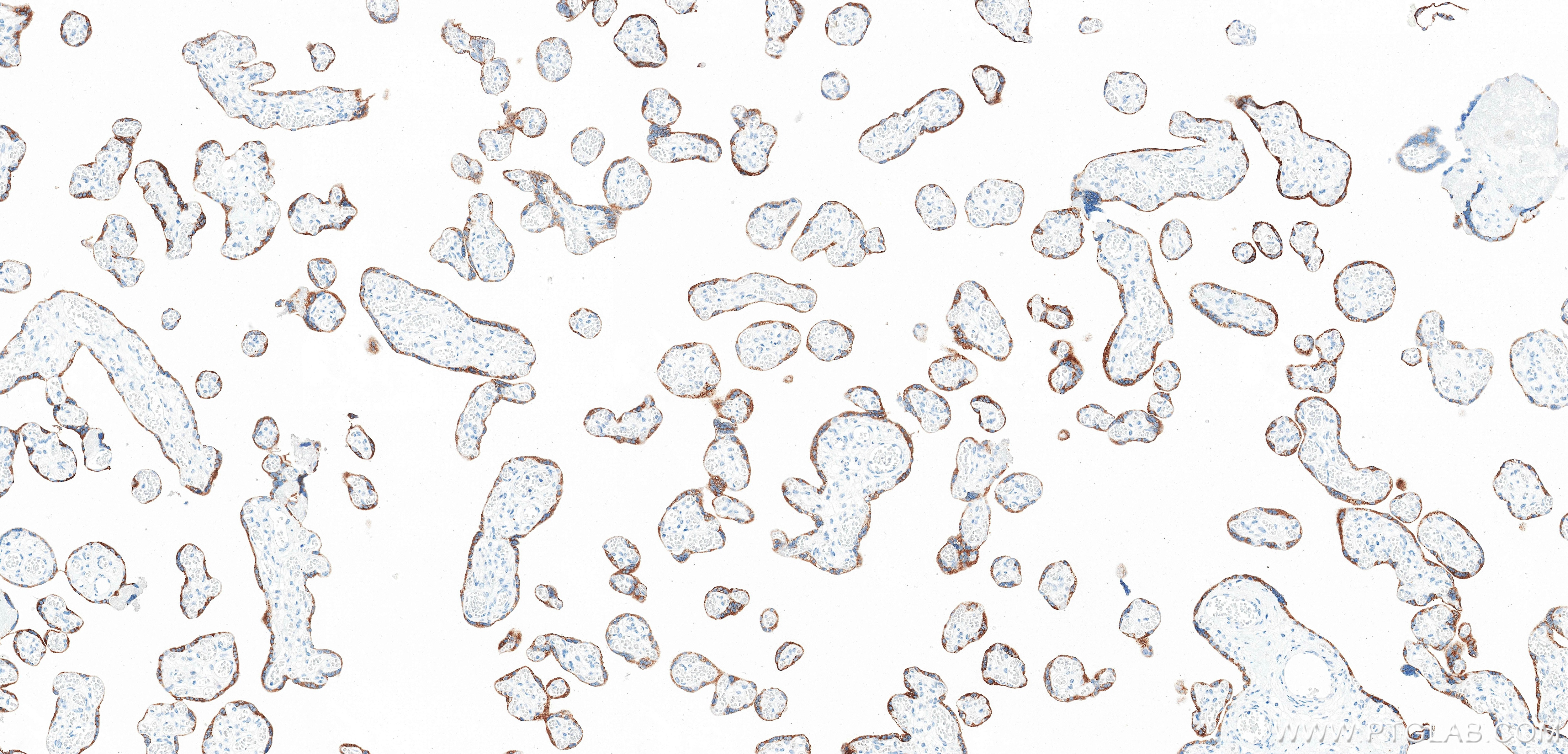 IHC staining of human placenta using 88055-1-RR (same clone as 88055-1-PBS) Immunohistochemistry (IHC) staining of human placenta tissue using KISS1 Recombinant monoclonal antibody (88055-1-RR)