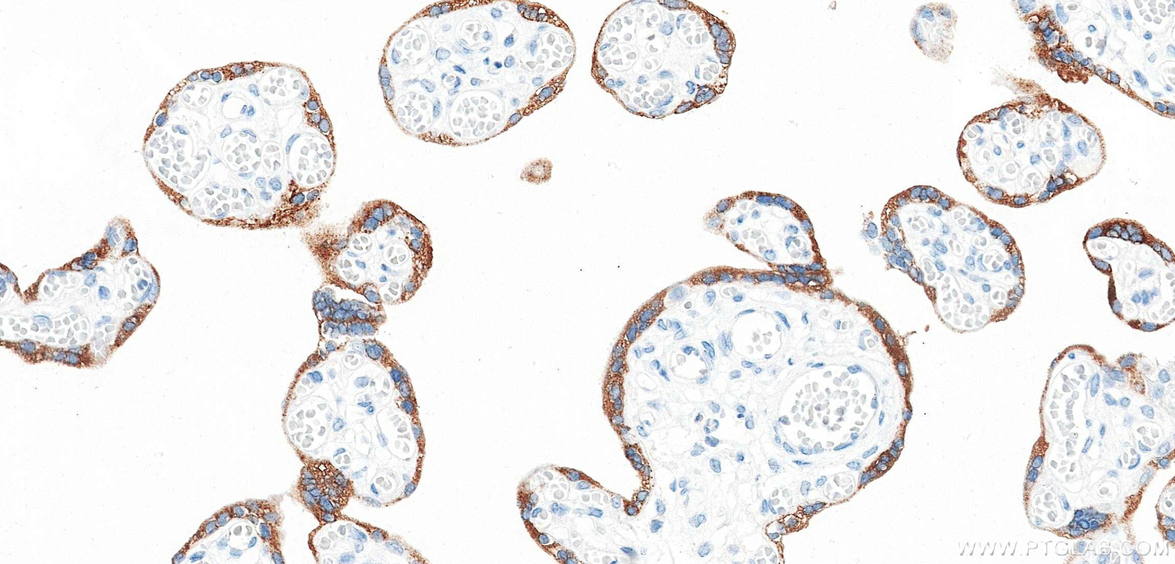IHC staining of human placenta using 88055-1-RR (same clone as 88055-1-PBS) Immunohistochemistry (IHC) staining of human placenta tissue using KISS1 Recombinant monoclonal antibody (88055-1-RR)
