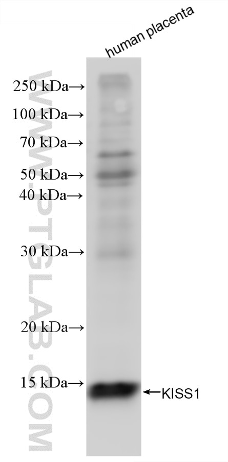 WB analysis using 88055-1-RR (same clone as 88055-1-PBS) Western Blot (WB) analysis of various lysates using KISS1 Recombinant monoclonal antibody (88055-1-RR)