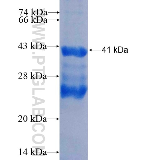 KISS1 fusion protein Ag13240 SDS-PAGE
