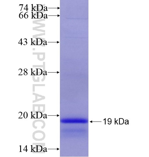 KISS1R fusion protein Ag15313 SDS-PAGE