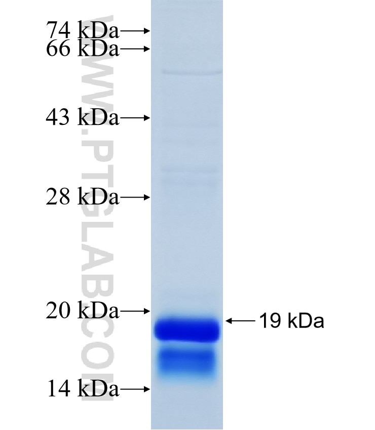 KISS1R fusion protein Ag15313 SDS-PAGE