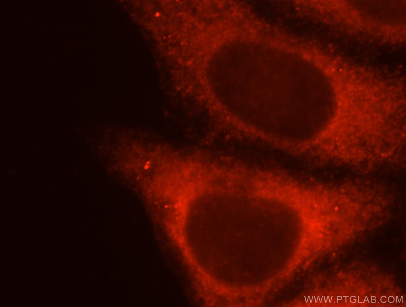 Immunofluorescence (IF) / fluorescent staining of HepG2 cells using KISS1R-Specific Polyclonal antibody (15505-1-AP)