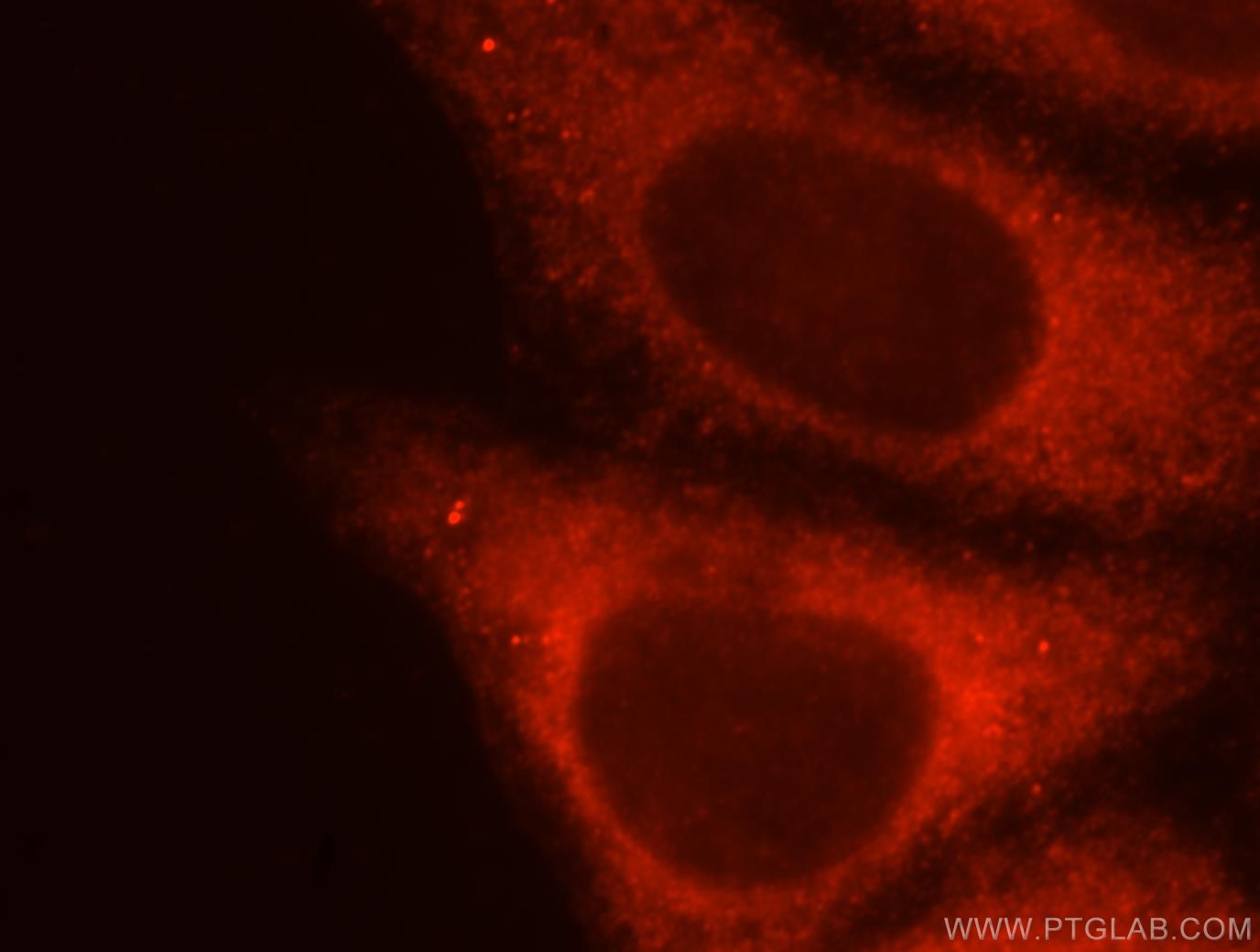 IF Staining of HepG2 using 15505-1-AP