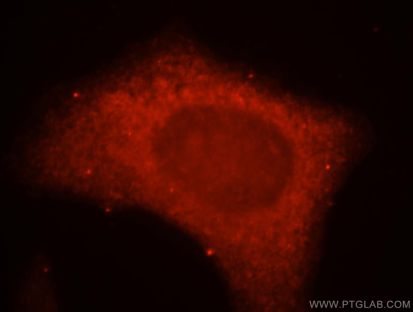 Immunofluorescence (IF) / fluorescent staining of MCF-7 cells using KISS1R-Specific Polyclonal antibody (15505-1-AP)