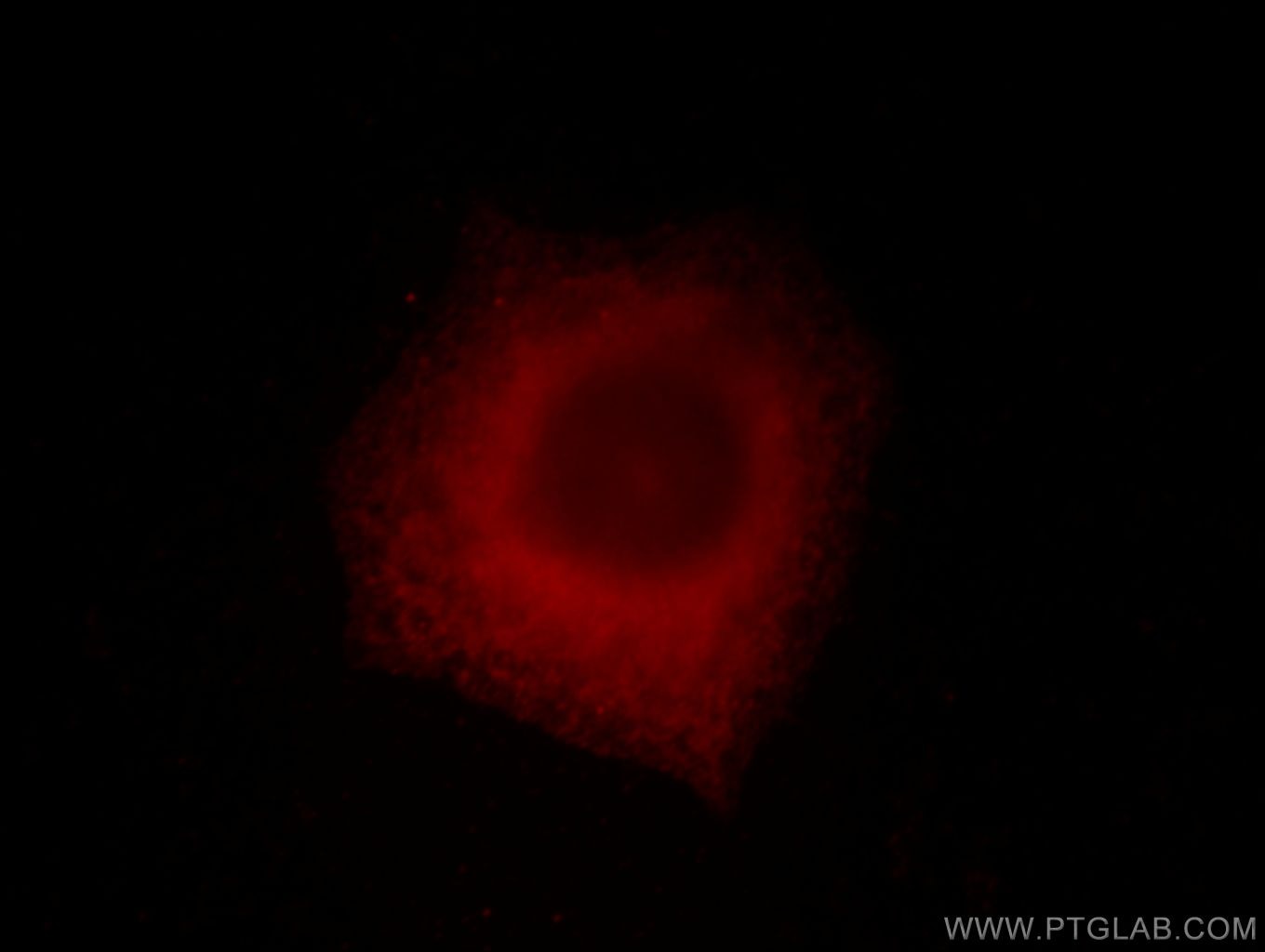IF Staining of HeLa using 15505-1-AP