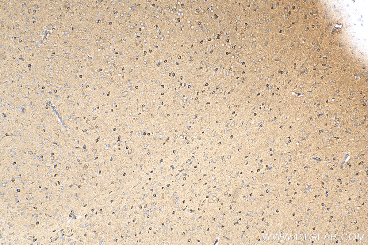 Immunohistochemistry (IHC) staining of mouse cerebellum tissue using KISS1R-Specific Polyclonal antibody (15505-1-AP)