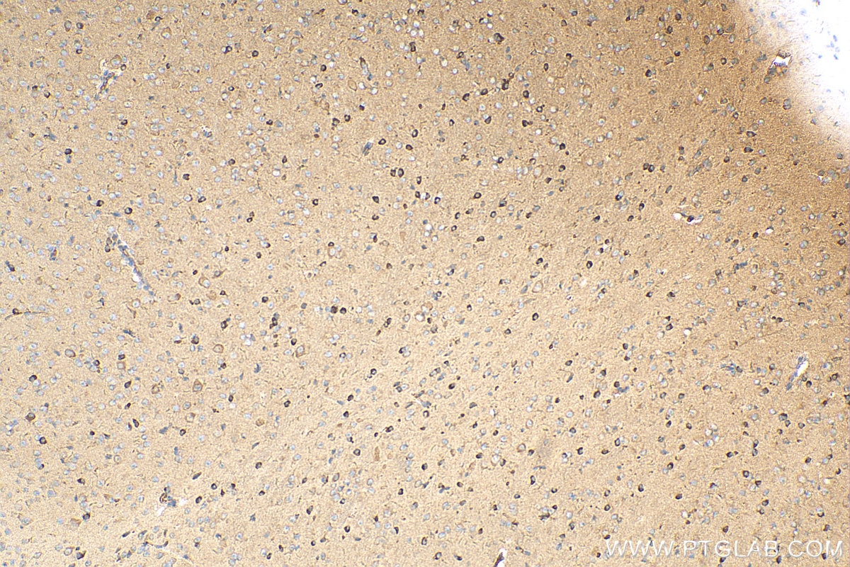 IHC staining of mouse cerebellum using 15505-1-AP