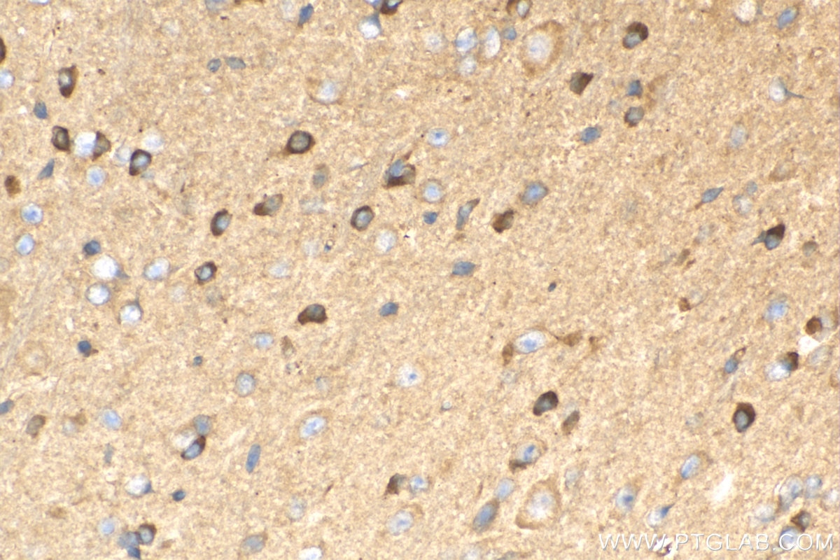 Immunohistochemistry (IHC) staining of mouse cerebellum tissue using KISS1R-Specific Polyclonal antibody (15505-1-AP)