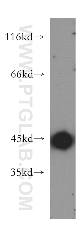 Western Blot (WB) analysis of MCF-7 cells using KISS1R-Specific Polyclonal antibody (15505-1-AP)