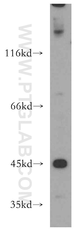 Western Blot (WB) analysis of SH-SY5Y cells using KISS1R-Specific Polyclonal antibody (15505-1-AP)