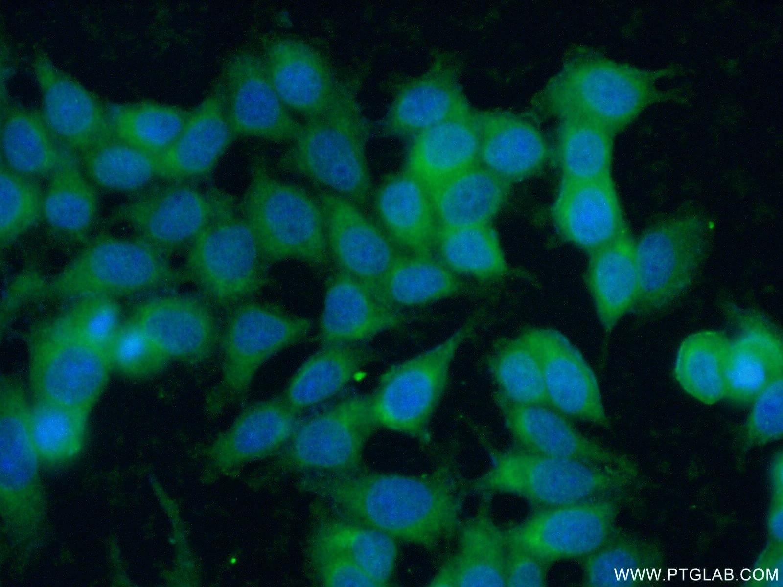 Immunofluorescence (IF) / fluorescent staining of MCF-7 cells using c-Kit/CD117 Polyclonal antibody (18696-1-AP)