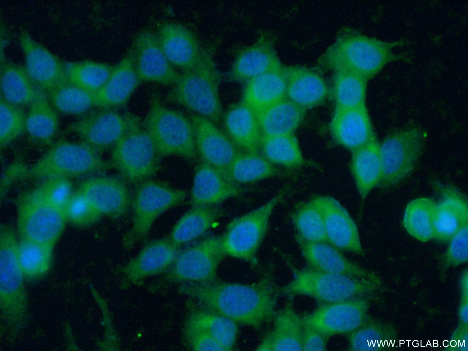 IF Staining of MCF-7 using 18696-1-AP