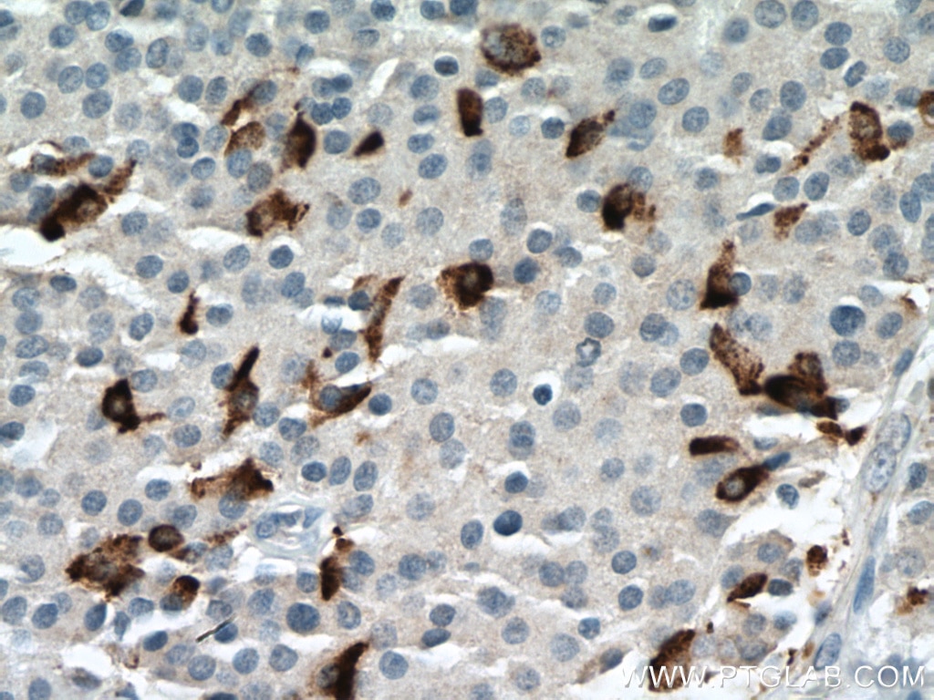 IHC staining of Insulinoma using 18696-1-AP