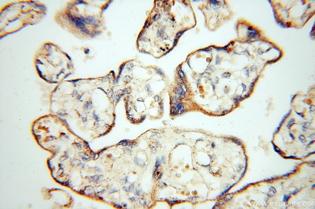 Immunohistochemistry (IHC) staining of human placenta tissue using c-Kit/CD117 Polyclonal antibody (18696-1-AP)