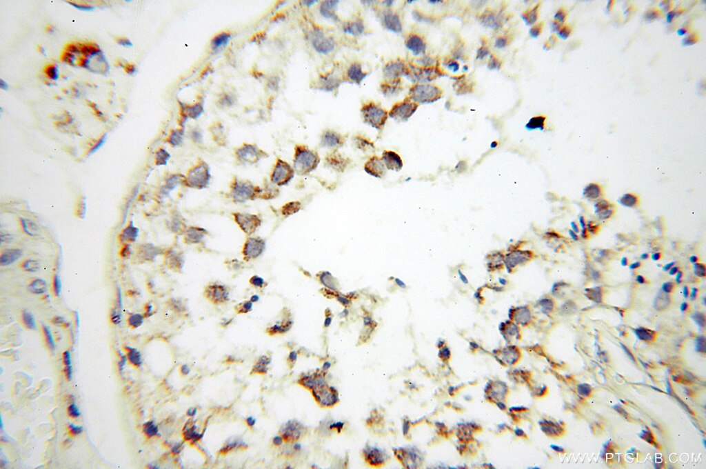 Immunohistochemistry (IHC) staining of human testis tissue using c-Kit/CD117 Polyclonal antibody (18696-1-AP)