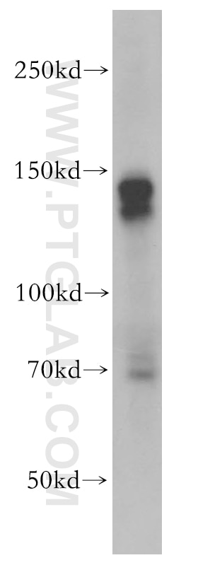c-Kit/CD117 Polyclonal antibody