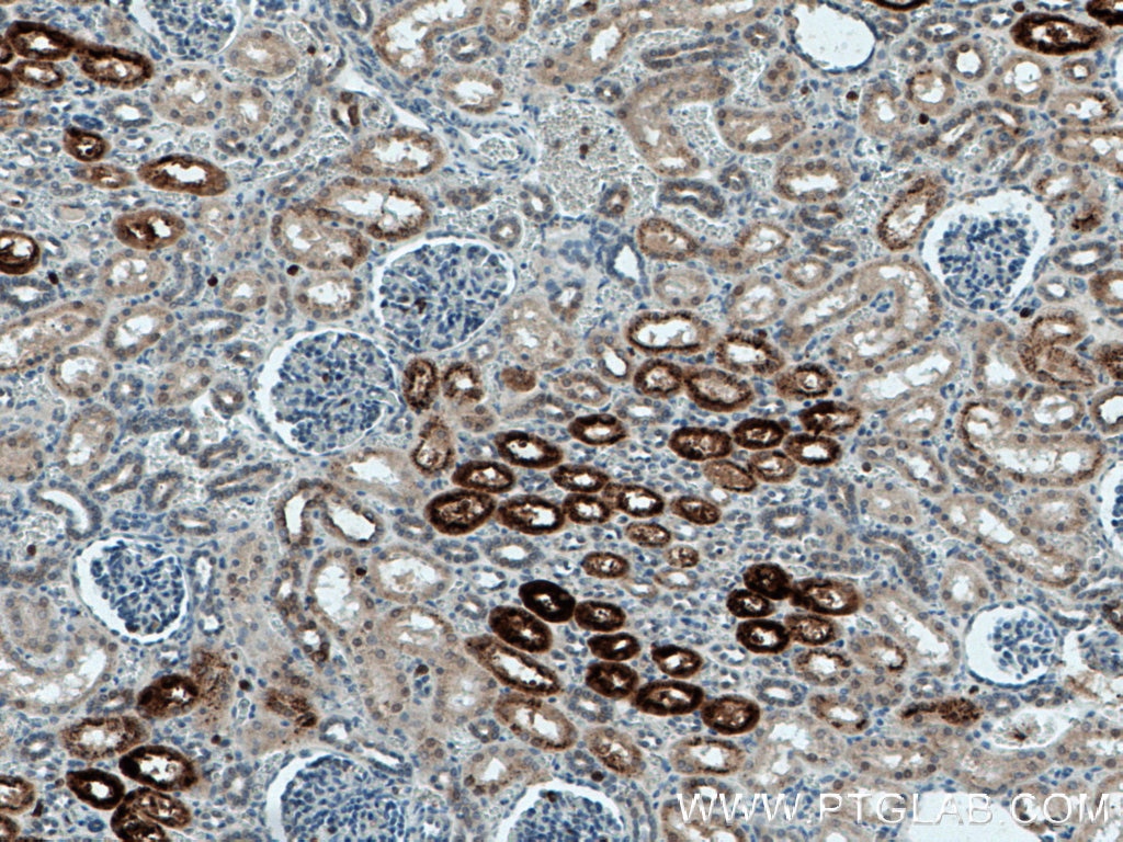 Immunohistochemistry (IHC) staining of human kidney tissue using KL Polyclonal antibody (28100-1-AP)