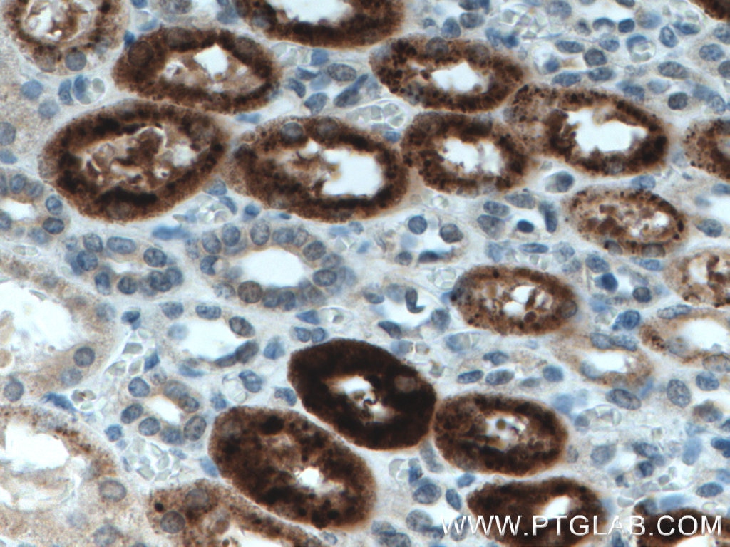 Immunohistochemistry (IHC) staining of human kidney tissue using KL Polyclonal antibody (28100-1-AP)