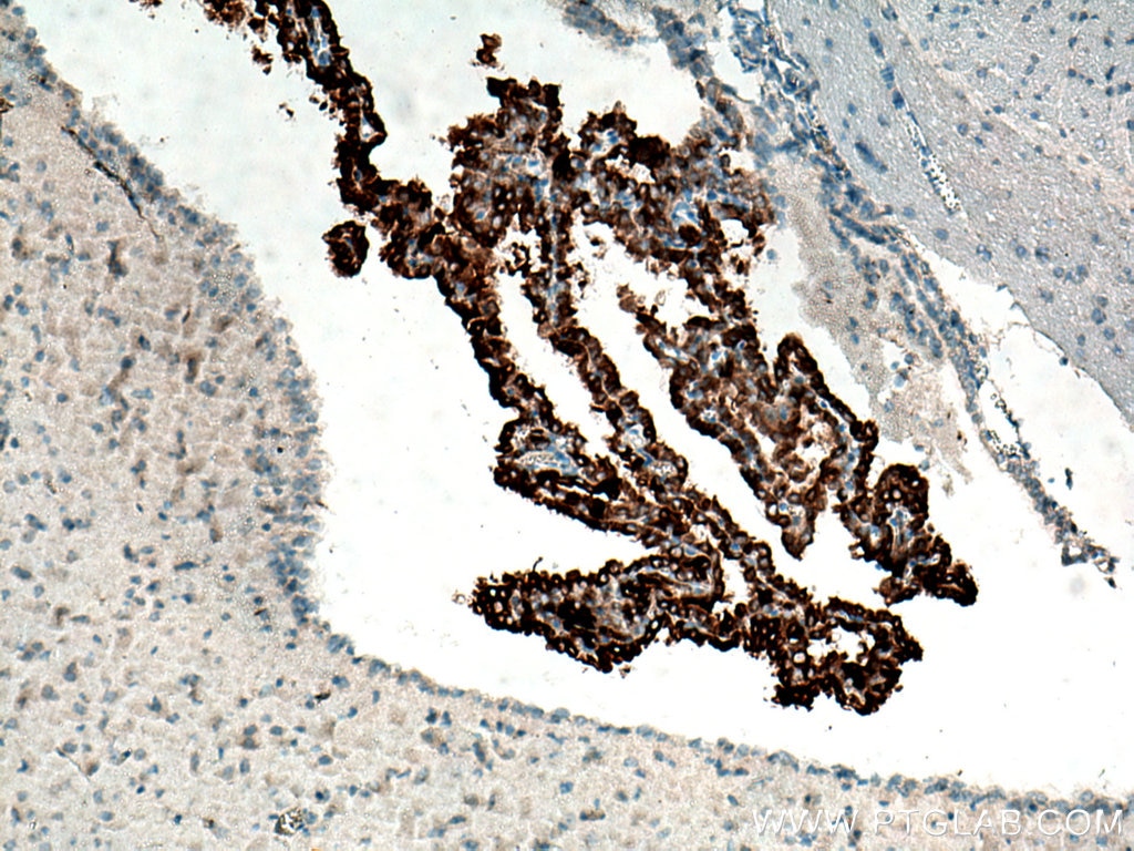 Immunohistochemistry (IHC) staining of mouse brain tissue using KL Polyclonal antibody (28100-1-AP)