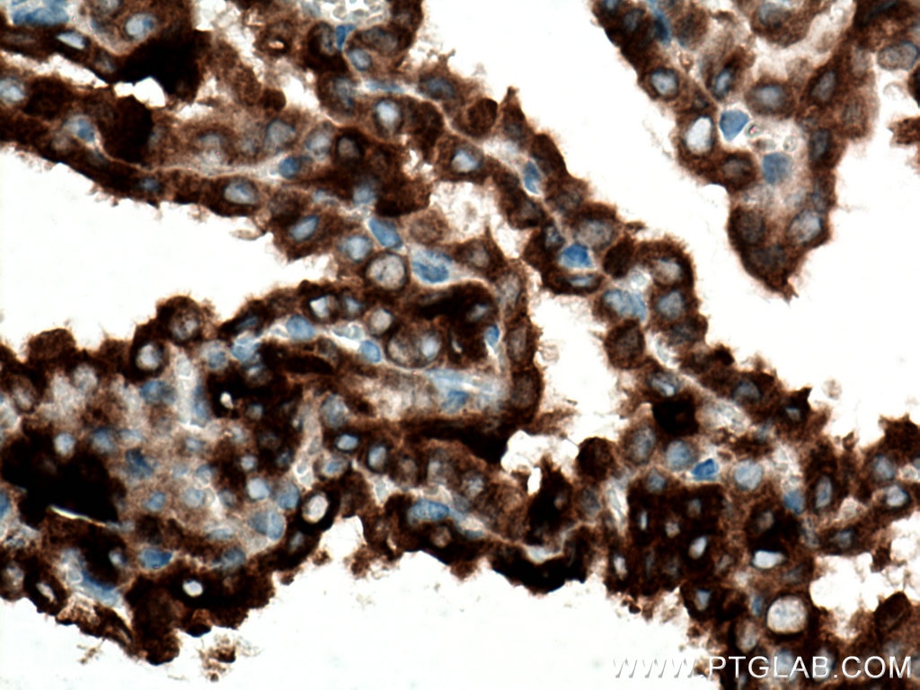 Immunohistochemistry (IHC) staining of mouse brain tissue using KL Polyclonal antibody (28100-1-AP)