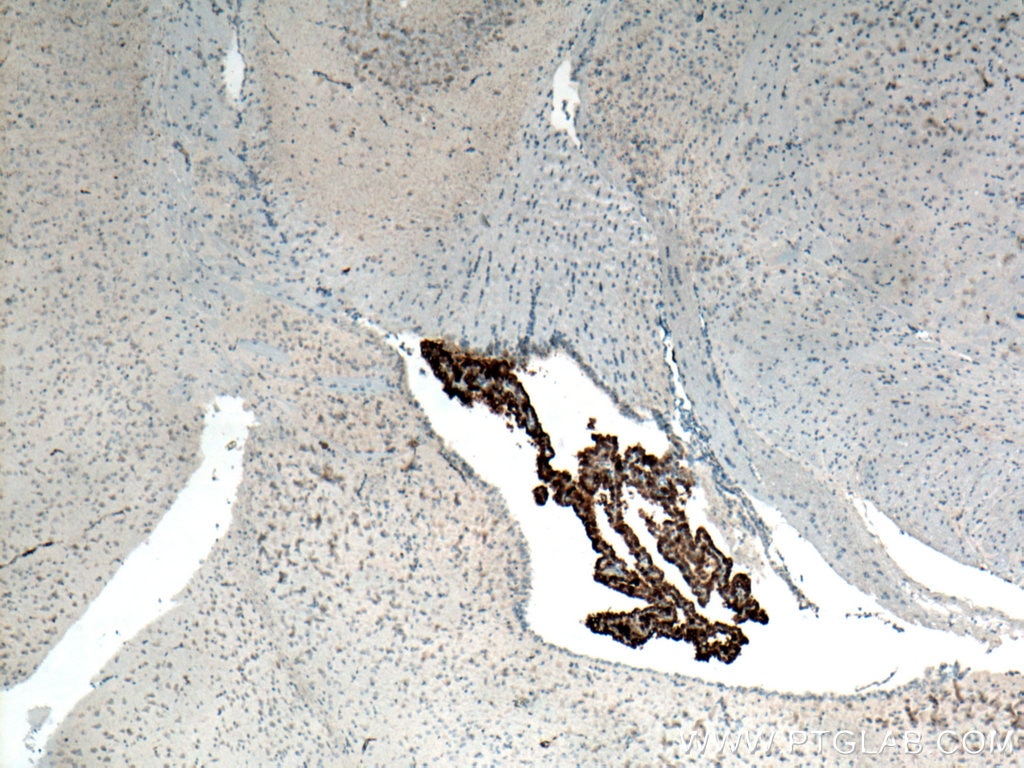 Immunohistochemistry (IHC) staining of mouse brain tissue using KL Polyclonal antibody (28100-1-AP)