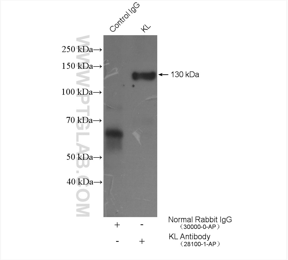 Immunoprecipitation (IP) experiment of mouse kidney tissue using KL Polyclonal antibody (28100-1-AP)