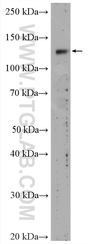 Western Blot (WB) analysis of mouse kidney tissue using KL Polyclonal antibody (28100-1-AP)
