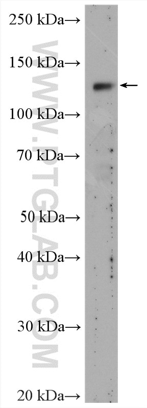 WB analysis of mouse kidney using 28100-1-AP