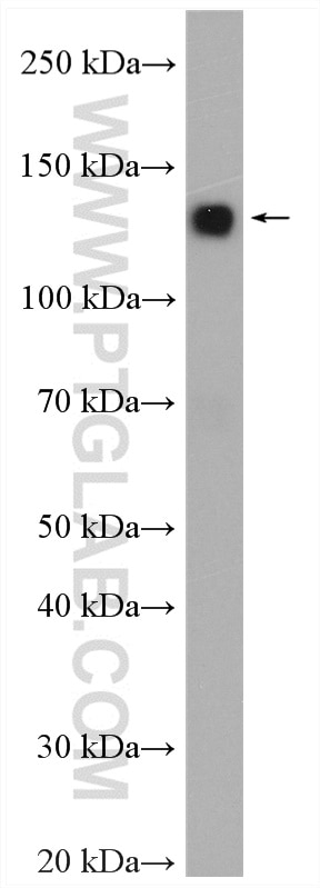 Western Blot (WB) analysis of mouse kidney tissue using KL Polyclonal antibody (28100-1-AP)
