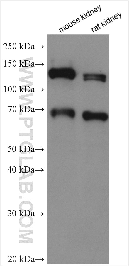 Western Blot (WB) analysis of various lysates using KL Polyclonal antibody (28100-1-AP)